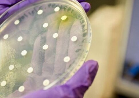 baktēriju kultūra prostatīta diagnostikai